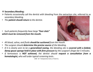 UDM - AY - Postoperative Comp. of Tooth Ex.
❖ Secondary Bleeding:
➢ Patients occasionally call the dentist with bleeding from the extraction site, referred to as
secondary bleeding.
• The patient should return to the dentist.
• Such patients frequently have large “liver clots”
which must be removed from the mouth.
• All blood, saliva, and fluids should be suctioned from the mouth.
• The surgeon should determine the precise source of the bleeding.
• If it is clearly seen to be a generalized oozing, the bleeding site is covered with a folded,
damp gauze sponge held in place with firm pressure by the surgeon’s finger for 5 minutes.
• If hemostasis is NOT achieved, the dentist should request a consultation from a
hematologist, who will order typical screening tests..
 