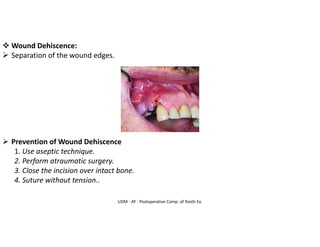 UDM - AY - Postoperative Comp. of Tooth Ex.
❖ Wound Dehiscence:
➢ Separation of the wound edges.
➢ Prevention of Wound Dehiscence
1. Use aseptic technique.
2. Perform atraumatic surgery.
3. Close the incision over intact bone.
4. Suture without tension..
 