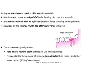 UDM - AY - Postoperative Comp. of Tooth Ex.
❖ Dry socket (alveolar osteitis - fibrinolytic alveolitis)
➢ It is the most common and painful in the healing of extraction wounds.
➢ It is NOT associated with an infection (without fever, swelling, and erythema).
➢ Develops on the third or fourth day after removal of the tooth.
➢ The occurrence of a dry socket:
• Rare after a routine tooth extraction (2% of extractions).
• Frequent after the removal of impacted mandibular third molars and other
lower molars (20% of extractions)..
 