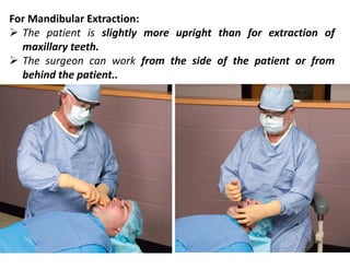 For Mandibular Extraction:
➢ The patient is slightly more upright than for extraction of
maxillary teeth.
➢ The surgeon can work from the side of the patient or from
behind the patient..
 