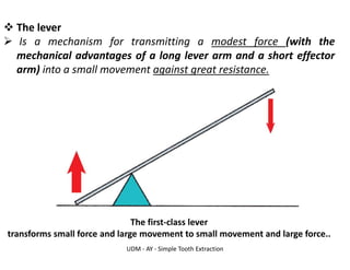 UDM - AY - Simple Tooth Extraction
❖ The lever
➢ Is a mechanism for transmitting a modest force (with the
mechanical advantages of a long lever arm and a short effector
arm) into a small movement against great resistance.
The first-class lever
transforms small force and large movement to small movement and large force..
 