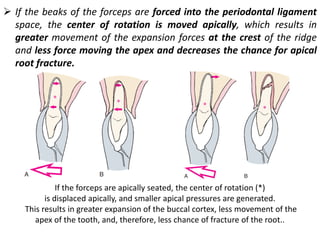 ➢ If the beaks of the forceps are forced into the periodontal ligament
space, the center of rotation is moved apically, which results in
greater movement of the expansion forces at the crest of the ridge
and less force moving the apex and decreases the chance for apical
root fracture.
If the forceps are apically seated, the center of rotation (*)
is displaced apically, and smaller apical pressures are generated.
This results in greater expansion of the buccal cortex, less movement of the
apex of the tooth, and, therefore, less chance of fracture of the root..
 