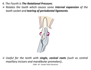 UDM - AY - Simple Tooth Extraction
4. The Fourth Is The Rotational Pressure;
➢ Rotates the tooth which causes some internal expansion of the
tooth socket and tearing of periodontal ligaments.
➢ Useful for the teeth with single, conical roots (such as central
maxillary incisors and mandibular premolars)..
 