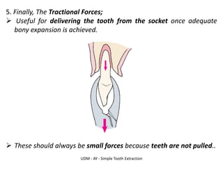 UDM - AY - Simple Tooth Extraction
5. Finally, The Tractional Forces;
➢ Useful for delivering the tooth from the socket once adequate
bony expansion is achieved.
➢ These should always be small forces because teeth are not pulled..
 