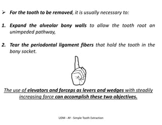 UDM - AY - Simple Tooth Extraction
➢ For the tooth to be removed, it is usually necessary to:
1. Expand the alveolar bony walls to allow the tooth root an
unimpeded pathway,
2. Tear the periodontal ligament fibers that hold the tooth in the
bony socket.
The use of elevators and forceps as levers and wedges with steadily
increasing force can accomplish these two objectives.
 