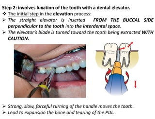 Step 2: involves luxation of the tooth with a dental elevator.
❖ The initial step in the elevation process:
➢ The straight elevator is inserted FROM THE BUCCAL SIDE
perpendicular to the tooth into the interdental space.
➢ The elevator’s blade is turned toward the tooth being extracted WITH
CAUTION.
➢ Strong, slow, forceful turning of the handle moves the tooth.
➢ Lead to expansion the bone and tearing of the PDL..
 