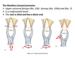 UDM - AY - Simple Tooth Extraction
The Maxillary Second premolar:
➢ Upper universal forceps (No. 150) - forceps (No. 150A) and (No. 7).
➢ Is a singlerooted tooth .
➢ The root is thick and has a blunt end.
 