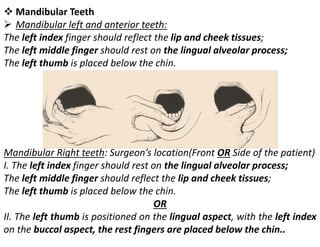 ❖ Mandibular Teeth
➢ Mandibular left and anterior teeth:
The left index finger should reflect the lip and cheek tissues;
The left middle finger should rest on the lingual alveolar process;
The left thumb is placed below the chin.
Mandibular Right teeth: Surgeon’s location(Front OR Side of the patient)
I. The left index finger should rest on the lingual alveolar process;
The left middle finger should reflect the lip and cheek tissues;
The left thumb is placed below the chin.
OR
II. The left thumb is positioned on the lingual aspect, with the left index
on the buccal aspect, the rest fingers are placed below the chin..
 