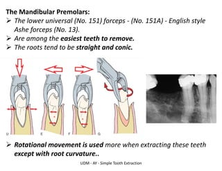 UDM - AY - Simple Tooth Extraction
The Mandibular Premolars:
➢ The lower universal (No. 151) forceps - (No. 151A) - English style
Ashe forceps (No. 13).
➢ Are among the easiest teeth to remove.
➢ The roots tend to be straight and conic.
➢ Rotational movement is used more when extracting these teeth
except with root curvature..
 