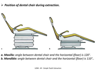 UDM - AY - Simple Tooth Extraction
➢ Position of dental chair during extraction.
a. Maxilla: angle between dental chair and the horizontal (floor) is 120°.
b. Mandible: angle between dental chair and the horizontal (floor) is 110°..
 