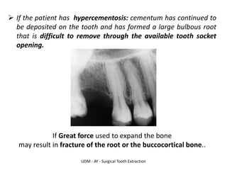 UDM - AY - Surgical Tooth Extraction
➢ If the patient has hypercementosis: cementum has continued to
be deposited on the tooth and has formed a large bulbous root
that is difficult to remove through the available tooth socket
opening.
If Great force used to expand the bone
may result in fracture of the root or the buccocortical bone..
 