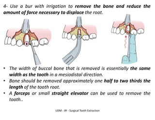UDM - AY - Surgical Tooth Extraction
4- Use a bur with irrigation to remove the bone and reduce the
amount of force necessary to displace the root.
• The width of buccal bone that is removed is essentially the same
width as the tooth in a mesiodistal direction.
• Bone should be removed approximately one half to two thirds the
length of the tooth root.
• A forceps or small straight elevator can be used to remove the
tooth..
 