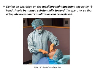 UDM - AY - Simple Tooth Extraction
➢ During an operation on the maxillary right quadrant, the patient’s
head should be turned substantially toward the operator so that
adequate access and visualization can be achieved..
 