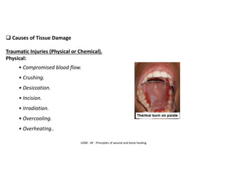 UDM - AY - Principles of wound and bone healing
❑ Causes of Tissue Damage
Traumatic Injuries (Physical or Chemical).
Physical:
• Compromised blood flow.
• Crushing.
• Desiccation.
• Incision.
• Irradiation.
• Overcooling.
• Overheating..
 