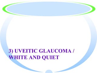 3) UVEITIC GLAUCOMA /
WHITE AND QUIET
 