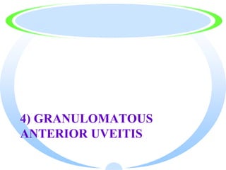 4) GRANULOMATOUS
ANTERIOR UVEITIS
 