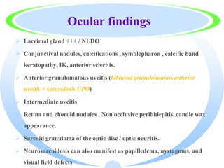Ocular findings
 Lacrimal gland +++ / NLDO
 Conjunctival nodules, calcifications , symblepharon , calcific band
keratopathy, IK, anterior scleritis.
 Anterior granulomatous uveitis (bilateral granulomatous anterior
uveitis = sarcoidosis UPO)
 Intermediate uveitis
 Retina and choroid nodules , Non occlusive peribhlepitis, candle wax
appearance.
 Sarcoid granuloma of the optic disc / optic neuritis.
 Neurosarcoidosis can also manifest as papilledema, nystagmus, and
visual field defects
 