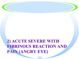 2) ACUTE SEVERE WITH
FIBRINOUS REACTION AND
PAIN (ANGRY EYE)
 