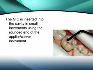 The tip of the index
finger is then placed
onto the central part
of the restorations to
enable the GIC to be
pressed firml...