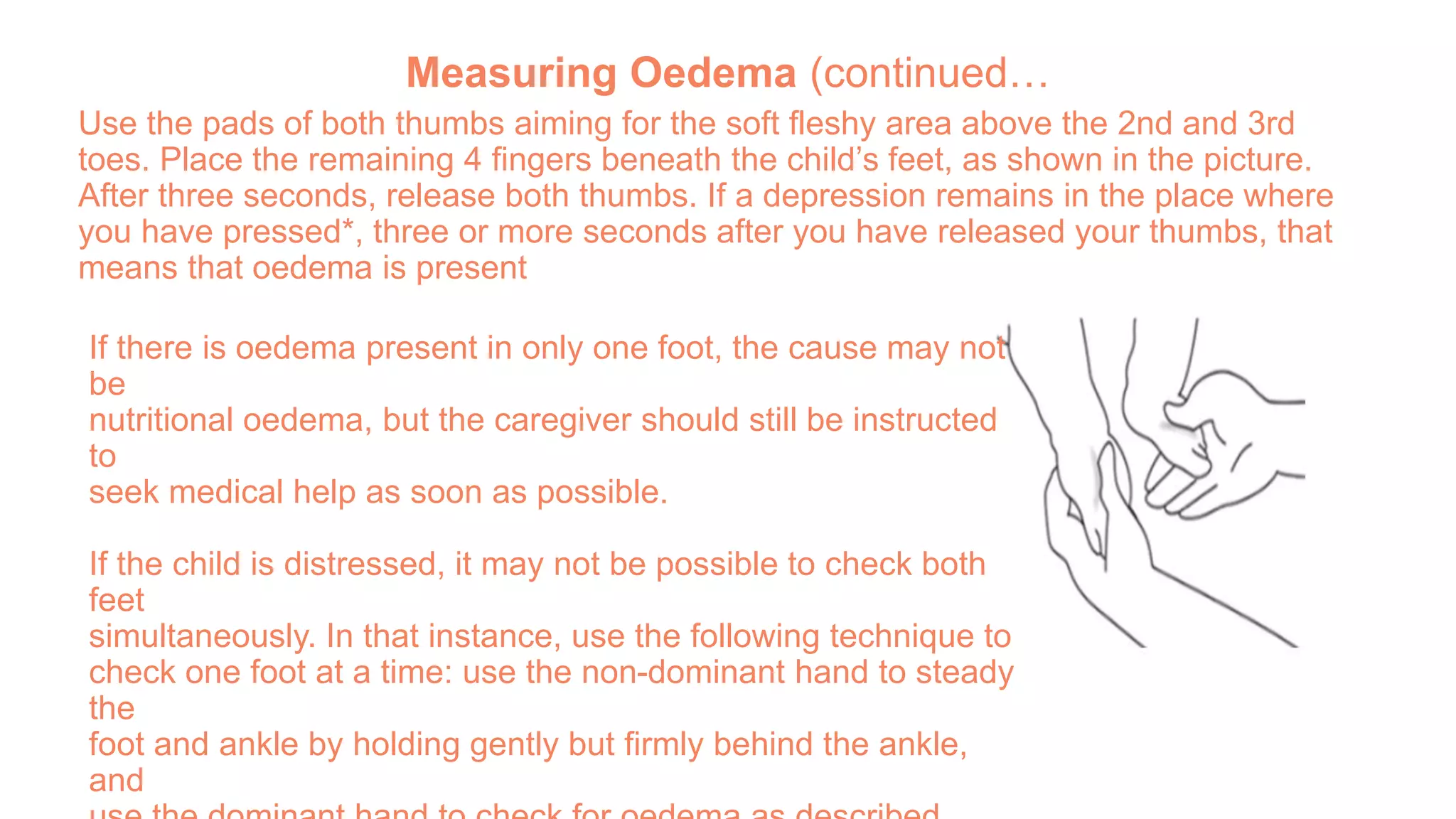 Measuring Oedema (continued…
Use the pads of both thumbs aiming for the soft fleshy area above the 2nd and 3rd
toes. Place the remaining 4 fingers beneath the child’s feet, as shown in the picture.
After three seconds, release both thumbs. If a depression remains in the place where
you have pressed*, three or more seconds after you have released your thumbs, that
means that oedema is present
If there is oedema present in only one foot, the cause may not
be
nutritional oedema, but the caregiver should still be instructed
to
seek medical help as soon as possible.
If the child is distressed, it may not be possible to check both
feet
simultaneously. In that instance, use the following technique to
check one foot at a time: use the non-dominant hand to steady
the
foot and ankle by holding gently but firmly behind the ankle,
and
 