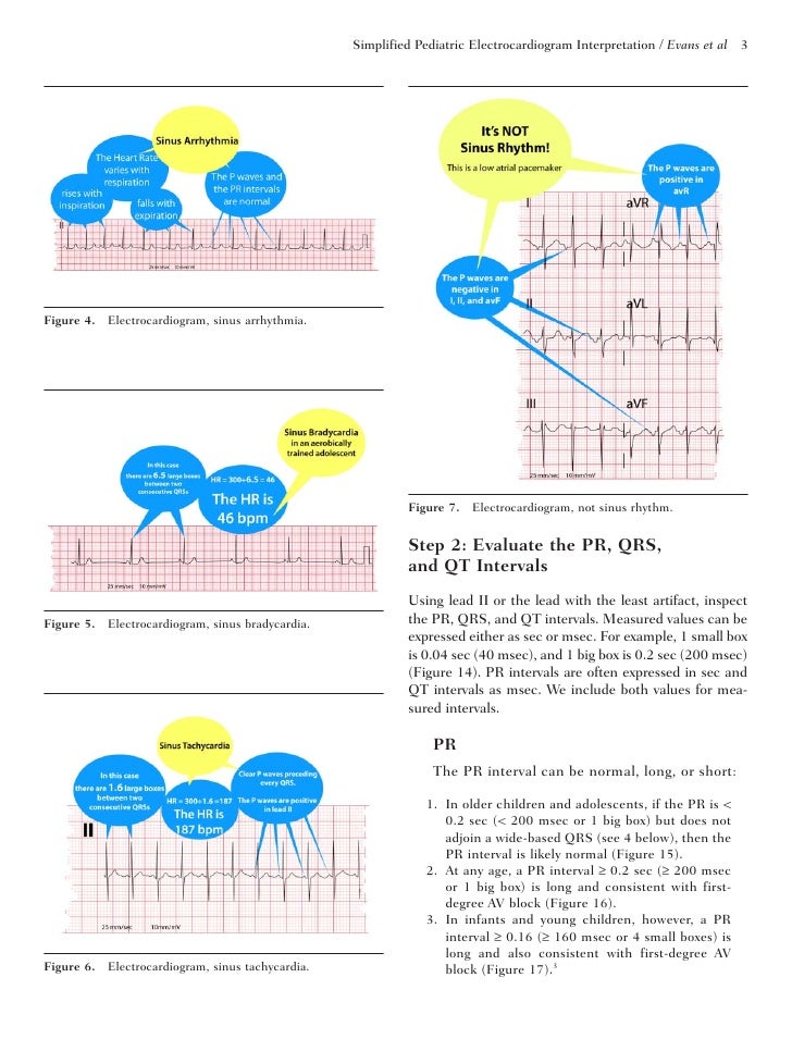 Simplified pediatric electrocardiogram interpretation