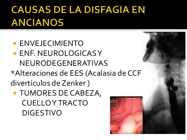 Resultado de imagen de disfagio en ancianos