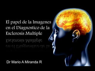 El papel de la Imagenes
en el Diagnostico de la
Esclerosis Multiple
Dr Mario A Miranda R
 