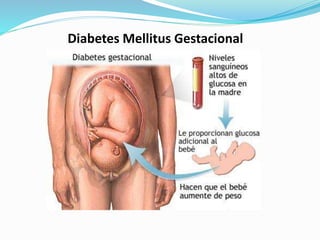 Diabetes Mellitus Gestacional
 