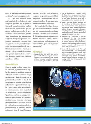 Highlights

está próxima ao osso, ou na fossa pos-

em que a lesão está junto ao leito cirúrgico e há grande susceptibilidade
magnética, a permeabilidade tem desempenho melhor do que a perfusão
para esclarecimento diagnóstico.
Em conclusão, Dra. Lara afirmou
que “em casos de metástases cerebrais,
que são lesões potencialmente fatais,
o melhor é realizar todos os exames
de RM: espectroscopia, imagens ponderadas em difusão e CDA, mapas e
curvas, tanto de perfusão quanto de
permeabilidade, para um diagnóstico

terior, ou com muitos efeitos de susce-

mais preciso”.

curva de perfusão é melhor do que na
metástase”5, esclareceu a palestrante.
Dra. Lara falou, também, sobre
qual sequência de perfusão seria mais
adequada, gradiente eco ou spin eco.
Em geral, o gradiente eco é melhor,
entretanto, em alguns casos, o spin eco
denota melhor desempenho. O gradiente eco é mais sensível aos grandes
vasos sanguíneos que caracterizam
neoplasias malignas e agressivas. “Entretanto, em situações em que a lesão

tibilidade relacionados à presença de
sangue e cálcio, o estudo de perfusão
com spin eco exibe melhor desempenho do que o estudo com gradiente
eco”, disse a médica.

Referências
1.	 Huang CF,  Chou HH,  Tu HT,  Yang MS,  Lee
JK,  Lin LY. Diffusion magnetic resonance
imaging as an evaluation of the response
of brain metastases treated by stereotactic
radiosurgery. Surg Neurol. 2008 Jan;69(1):62-8.

2.	 Patel TR, McHugh BJ, Bi WL, Minja FJ, Knisely
JP,  Chiang VL. A comprehensive review of
MR imaging changes following radiosurgery
to 500 brain metastases. AJNR Am J
Neuroradiol. 2011 Nov-Dec;32(10):1885-92.
3.	 Huang J,  Wang AM,  Shetty A,  Maitz AH,  Yan
D,  Doyle D,  et al. Differentiation between
intra-axial metastatic tumor progression
and radiation injury following fractionated
radiation therapy or stereotactic radiosurgery
using MR spectroscopy, perfusion MR imaging
or volume progression modeling. Magn Reson
Imaging. 2011 Sep;29(7):993-1001.
4.	
Hoefnagels FW,  Lagerwaard FJ,  Sanchez
E,  Haasbeek CJ,  Knol DL,  Slotman
BJ,  Vandertop WP. Radiological progression
of cerebral metastases after radiosurgery:
assessment of perfusion MRI for differentiating
between necrosis and recurrence. J
Neurol. 2009 Jun;256(6):878-87.
5.	Barajas RF,  Chang JS,  Sneed PK,  Segal
MR,  McDermott MW,  Cha S. Distinguishing
recurrent intra-axial metastatic tumor from
radiation necrosis following gamma knife
radiosurgery using dynamic susceptibilityweighted contrast-enhanced perfusion MR
imaging. AJNR Am J Neuroradiol. 2009
Feb;30(2):367-72.

Permeabilidade
Pode-se, ainda, realizar outro estudo funcional, a permeabilidade capilar. Em lesões metastáticas, em que a
BHE está ausente, o contraste atinge
rapidamente a lesão de modo que a
permeabilidade mostra-se alta. Já em
pacientes com necrose induzida pela
radioterapia, a permeabilidade capilar é baixa e a curva de permeabilidade mostra ascensão lenta e gradual.
De acordo com a neurorradiologista,
“para termos certeza de que a permeabilidade capilar da lesão está aumentada, é necessário comparar a curva da
permeabilidade da lesão com a curva
do parênquima normal, que não tem
permeabilidade e apresenta valores
próximos à linha de base”. Nos casos

13869 Highlights.indd 5

Dra. Lara Brandão demonstra diferentes estudos de permeabilidade.

06/06/12 14:26

 