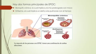 Hay dos formas principales de EPOC:
 Bronquitis crónica, la cual implica una tos prolongada con moco
 Enfisema, el cual implica un daño a los pulmones con el tiempo
La mayoría de las personas con EPOC tienen una combinación de ambas
afecciones.
 