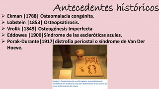 Antecedentes históricos 
 Ekman |1788| Osteomalacia congénita. 
 Lobstein |1853| Osteopsatirosis. 
 Vrolik |1849| Osteogénesis Imperfecta 
 Eddowes |1900|Síndrome de las escleróticas azules. 
 Porak-Durante|1917|distrofia periostal o síndrome de Van Der 
Hoeve. 
 