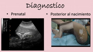 Diagnostico 
• Prenatal • Posterior al nacimiento 
 