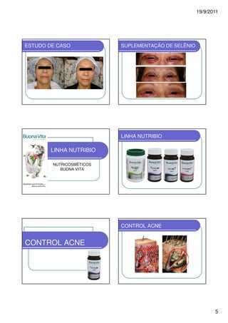 19/9/2011




ESTUDO DE CASO            SUPLEMENTAÇÃO DE SELÊNIO




                          LINHA NUTRIBIO

       LINHA NUTRIBIO

        NUTRICOSMÉTICOS
           BUONA VITA




                          CONTROL ACNE


CONTROL ACNE




                                                            5
 