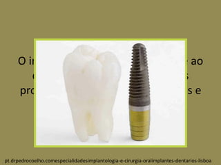 O implante dentário é semelhante ao
dente, no que concerne às suas
propriedades físicas, biomecânicas e
sensoriais?
pt.drpedrocoelho.comespecialidadesimplantologia-e-cirurgia-oralimplantes-dentarios-lisboa
 