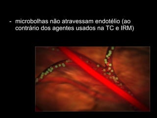 microbolhas não atravessam endotélio (ao contrário dos agentes usados na TC e IRM) 