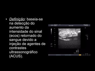 Definição : baseia-se na detecção do aumento da intensidade do sinal (ecos) retornado do sangue devido a injeção de agentes de contrastes ultrassonográfico (ACUS). 