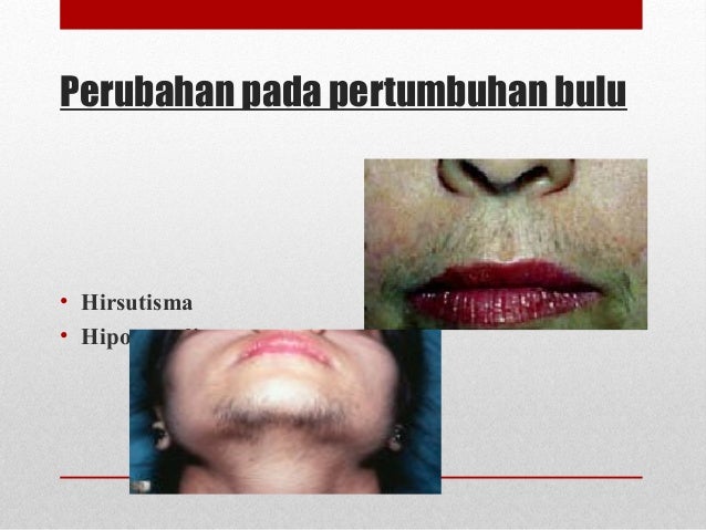 Simtomatologi sistem endokrina