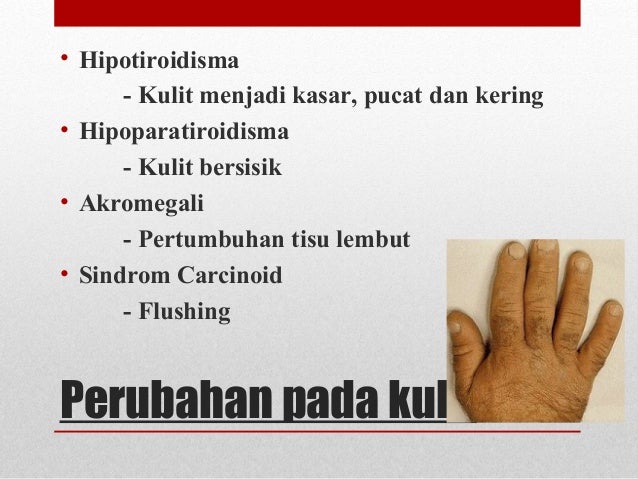 Simtomatologi sistem endokrina