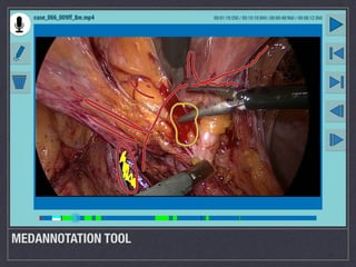 MEDANNOTATION TOOL
 