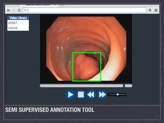 SEMI SUPERVISED ANNOTATION TOOL
 