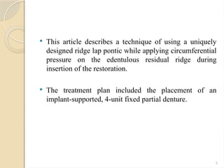 Innovative Pontic Design for Simulated Tissue in Implant-Supported ...