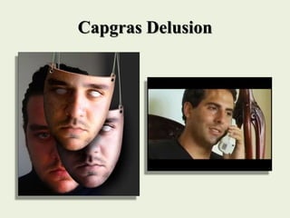 Capgras Delusion
 