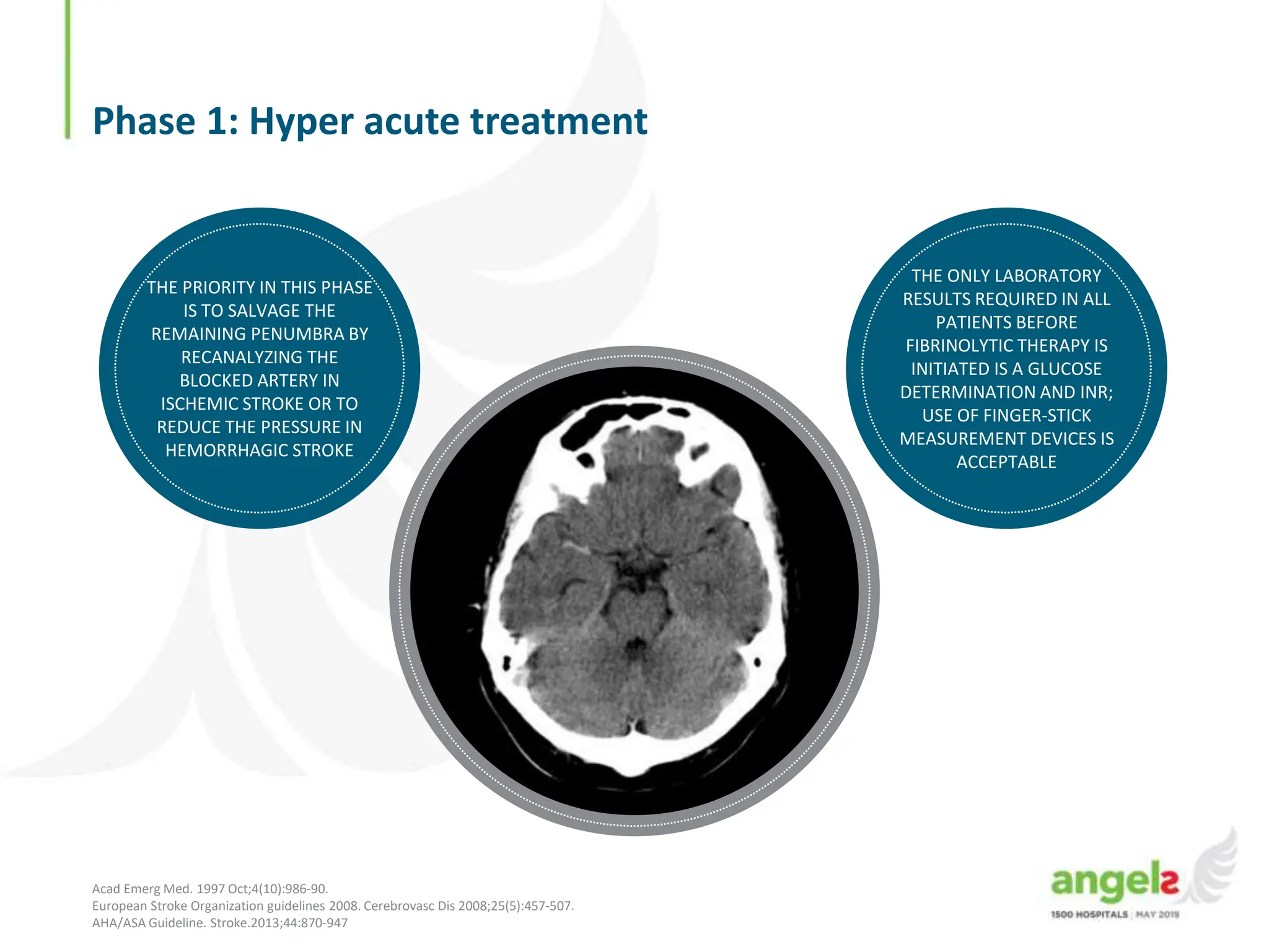 simulation acv angels presentation of stroke | PPTX