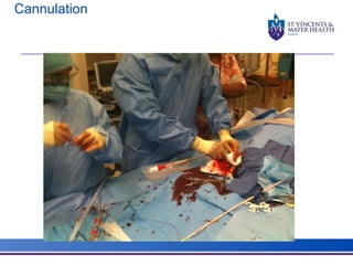 Cannulation 
 