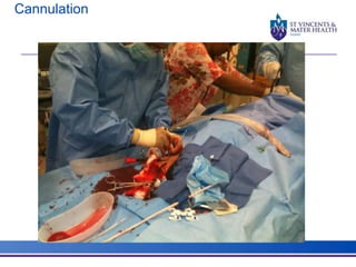 Cannulation 
 