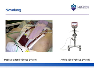 Novalung 
Passive arterio-venous System Active veno-venous System 
 