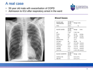 A real case 
64 
• 59 year old male with exacerbation of COPD 
• Admission to ICU after respiratory arrest in the ward 
 