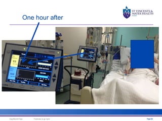 One hour after 
Day/Month/Year Footnote to go here Page 66 
 