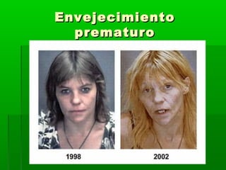 EnvejecimientoEnvejecimiento
prematuroprematuro
 