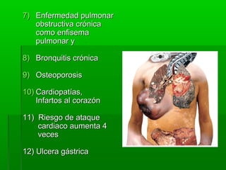 7)7) Enfermedad pulmonarEnfermedad pulmonar
obstructiva crónicaobstructiva crónica
como enfisemacomo enfisema
pulmonar ypulmonar y
8)8) Bronquitis crónicaBronquitis crónica
9)9) OsteoporosisOsteoporosis
10)10) Cardiopatías,Cardiopatías,
Infartos al corazónInfartos al corazón
11) Riesgo de ataque11) Riesgo de ataque
cardiaco aumenta 4cardiaco aumenta 4
vecesveces
12) Ulcera gástrica12) Ulcera gástrica
 